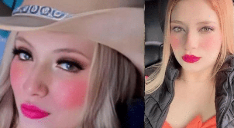 Vendió auto para pagar cirugía estética y murió en el quirófano