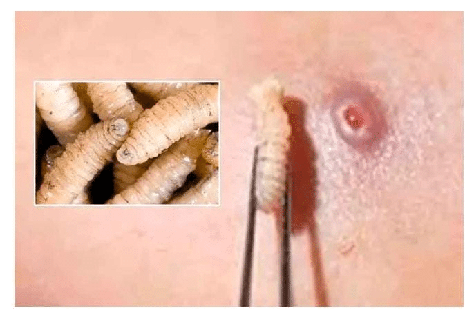 !Alerta! Llega ‘barrenador’ en humano a Estados Unidos.