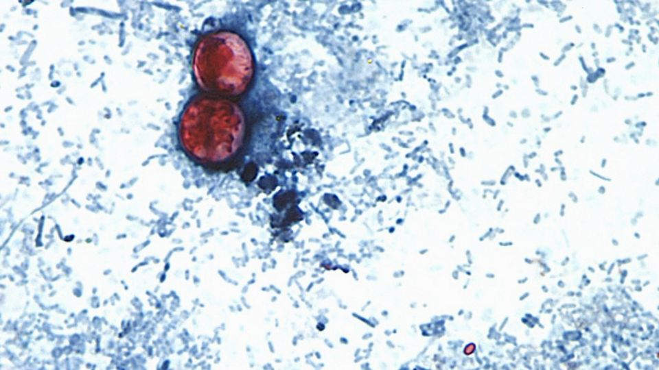 Confirman las primeras dos muertes por ciclosporiasis en EU; los casos se detectaron en Michigan